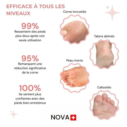Nova Suisse™ – Kit Beauté Pieds