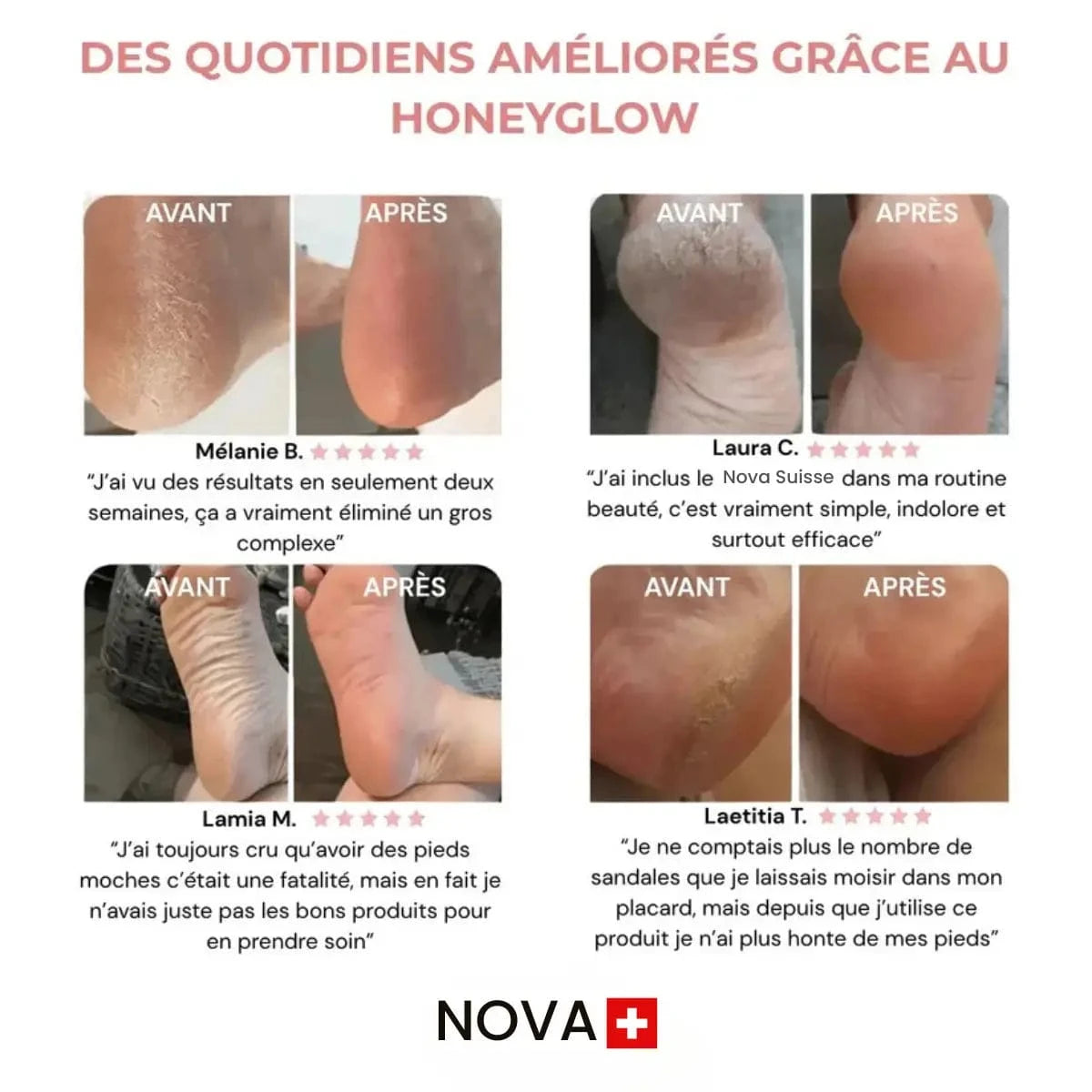 Nova Suisse™ – Kit Beauté Pieds
