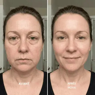 Nova - Brosse Drainage Lymphatique Visage