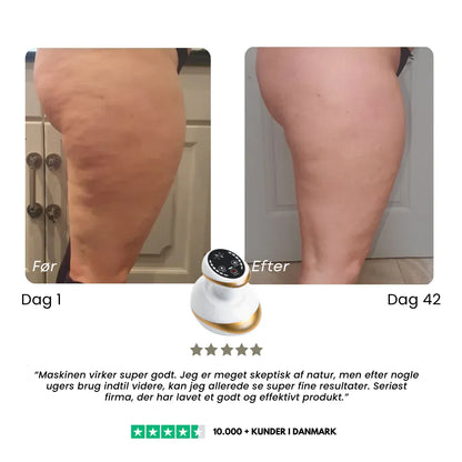 Nova – Appareil de massage