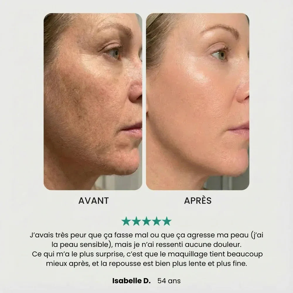 EpilSmooth Pro