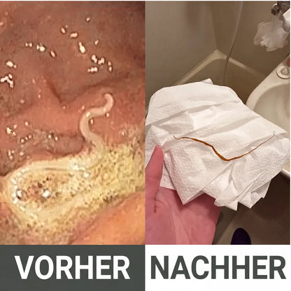 Detox-Set mit Rizinusöl