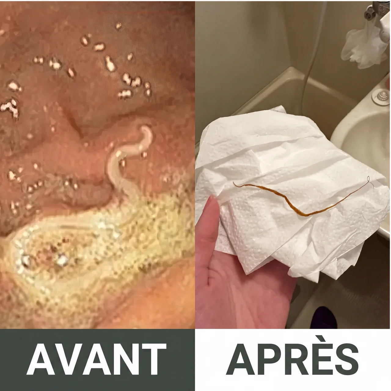 Kit détox à l’huile de ricin