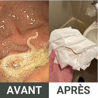 Kit détox à l’huile de ricin