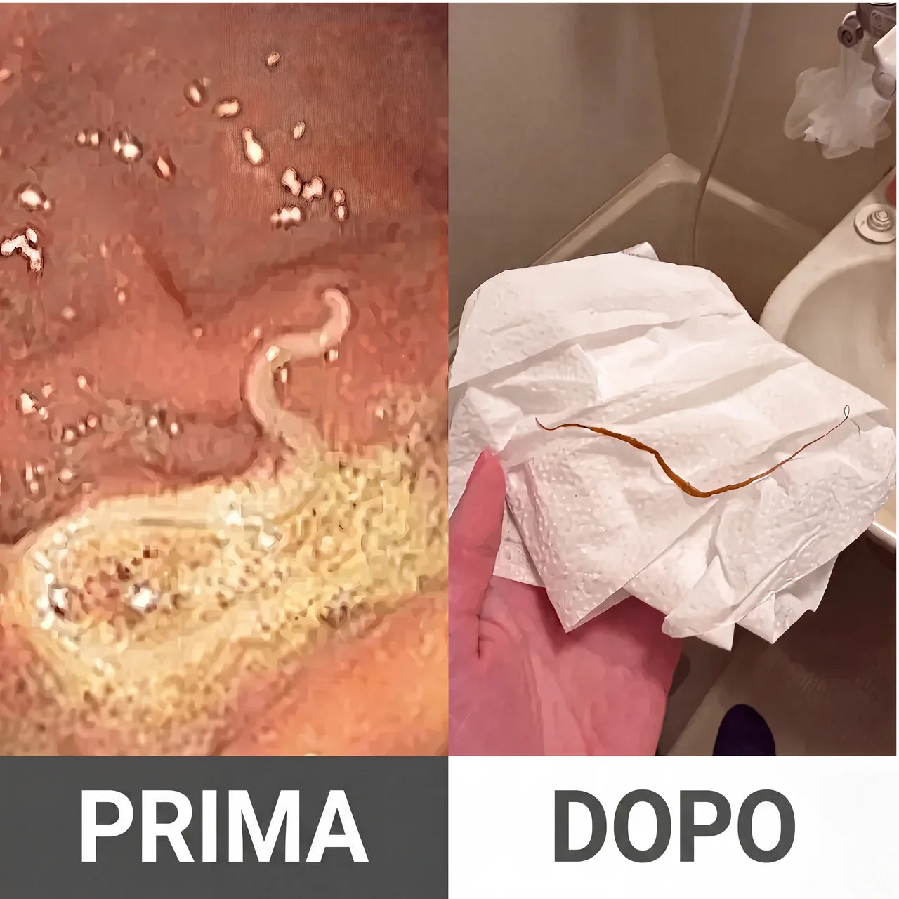 Kit detox con olio di ricino