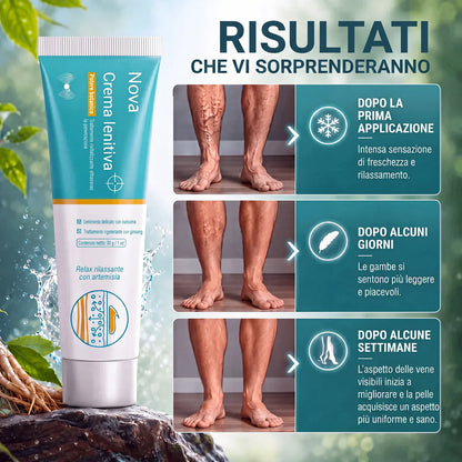 Gel contro le vene varicose e le gambe gonfie