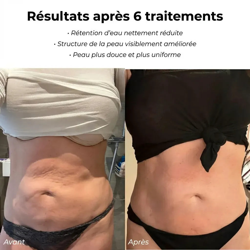 Nova – Appareil de massage